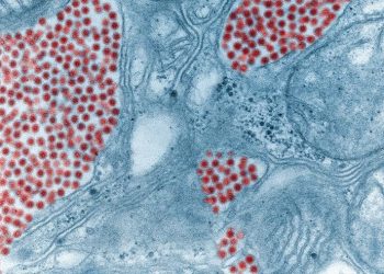 New York: allerta Encefalite Equina dell’Est, c’è il primo morto